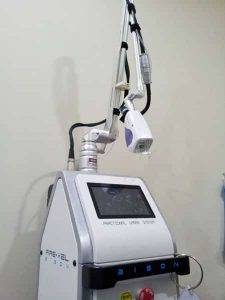 fractional CO2 laser