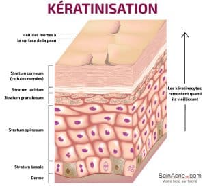 keratinization process