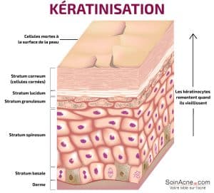 processus de kératinisation